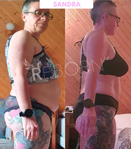 Transformation Sandra — avant/après
