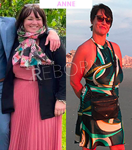 Transformation Anne — avant/après