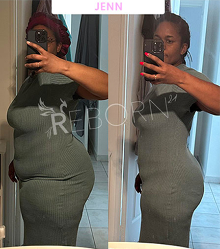 Transformation Jen — avant/après